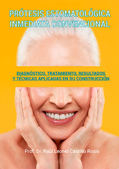 Prótesis estomatológica inmediata convencional (Libro)