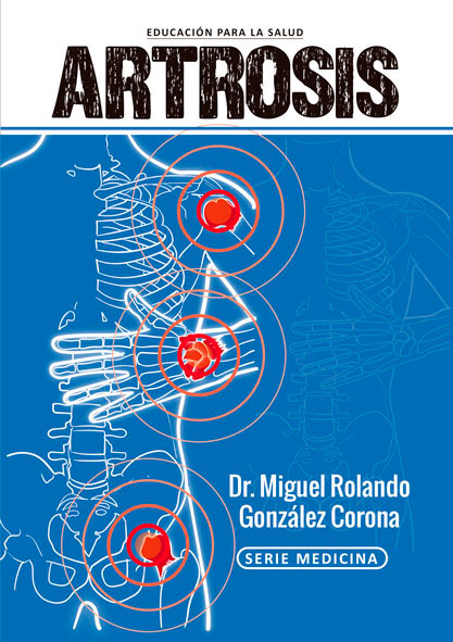 Artrosis (Libro)